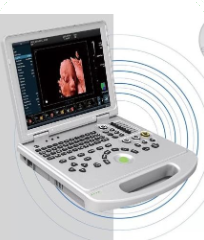 Color Doppler Ultrasound